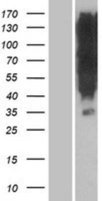 Western Blot: OR1K1 Overexpression Lysate (Adult Normal) [NBP2-05753] Left-Empty vector transfected control cell lysate (HEK293 cell lysate); Right -Over-expression Lysate for OR1K1.