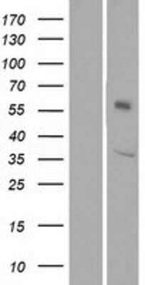 Western Blot: OR1L6 Overexpression Lysate (Adult Normal) [NBP2-08869] Left-Empty vector transfected control cell lysate (HEK293 cell lysate); Right -Over-expression Lysate for OR1L6.