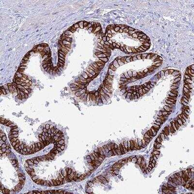 Immunohistochemistry-Paraffin: OR1Q1 Antibody [NBP1-92224] - Staining of human prostate shows strong membranous and cytoplasmic positivity in glandular cells.