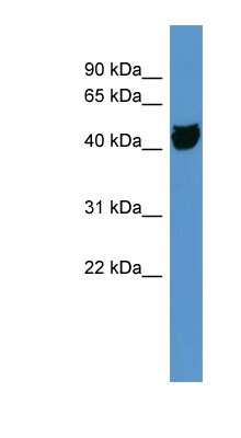 Western Blot: OR1S1 Antibody [NBP1-68969] - COLO205 cells lysate, concentration 0.2-1 ug/ml.