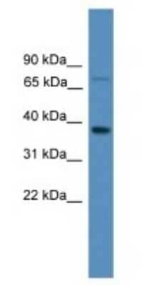 Western Blot: OR1S1 Antibody [NBP1-69090] - Human Fetal Lung Cell Lysate, concentration 1 ug/ml.