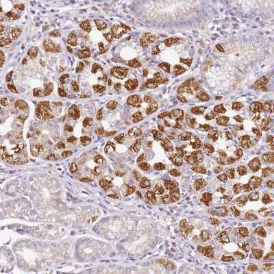 Immunohistochemistry-Paraffin: OR2B11 Antibody [NBP1-92225] - Staining of human stomach (lower) shows strong cytoplasmic positivity in parietal cells.