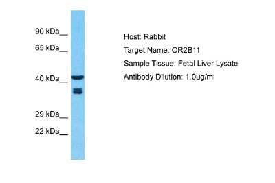 Western Blot: OR2B11 Antibody [NBP2-83313] - Host: Rabbit. Target Name: OR2B11. Sample Type: Fetal Liver lysates. Antibody Dilution: 1.0ug/ml