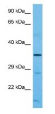 Western Blot: OR2B2 Antibody [NBP3-09389] - Western blot analysis of OR2B2 in Human Uterus Tumor. Antibody dilution at 1 ug/mL