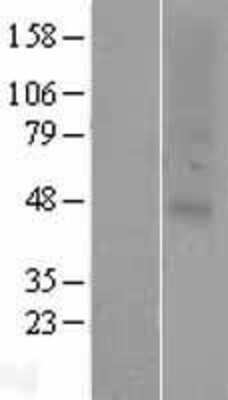 Western Blot: OR2C1 Overexpression Lysate (Adult Normal) [NBP2-07455] Left-Empty vector transfected control cell lysate (HEK293 cell lysate); Right -Over-expression Lysate for OR2C1.