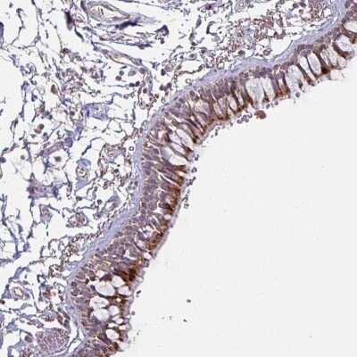 Immunohistochemistry: OR2D3 Antibody [NBP2-49049] - Staining of human bronchus shows strong cytoplasmic positivity in respiratory epithelial cells.