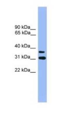 Western Blot: OR2D3 Antibody [NBP1-69086] - Titration: 1.0 ug/ml Positive Control: 293T Whole Cell.