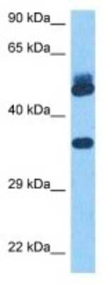 Western Blot: OR2G2 Antibody [NBP3-11000] - Western blot analysis of OR2G2 in Human Ovary Tumor lysates. Antibody dilution at 1ug/ml