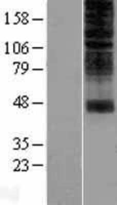 Western Blot OR2H1 Overexpression Lysate