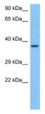 Western Blot: OR2J2 Antibody [NBP3-10004] - Western blot analysis of OR2J2 in Human 786-0 Whole Cell. Antibody dilution at 1.0ug/ml