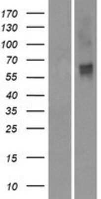 Western Blot: OR2M2 Overexpression Lysate (Adult Normal) [NBP2-08889] Left-Empty vector transfected control cell lysate (HEK293 cell lysate); Right -Over-expression Lysate for OR2M2.