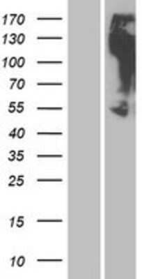 Western Blot: OR2M3 Overexpression Lysate (Adult Normal) [NBP2-08890] Left-Empty vector transfected control cell lysate (HEK293 cell lysate); Right -Over-expression Lysate for OR2M3.