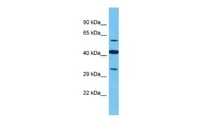 Western Blot: OR2M4 Antibody [NBP2-83314] - Host: Rabbit. Target Name: OR2M4. Sample Type: Jurkat Whole Cell lysates. Antibody Dilution: 1.0ug/ml