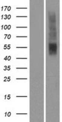 Western Blot: OR2T5 Overexpression Lysate (Adult Normal) [NBP2-08893] Left-Empty vector transfected control cell lysate (HEK293 cell lysate); Right -Over-expression Lysate for OR2T5.
