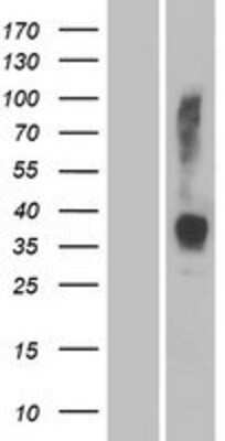 Western Blot: OR2W3 Overexpression Lysate (Adult Normal) [NBP2-08965] Left-Empty vector transfected control cell lysate (HEK293 cell lysate); Right -Over-expression Lysate for OR2W3.
