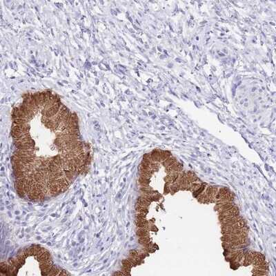 Immunohistochemistry-Paraffin: OR2Z1 Antibody [NBP2-13698] Staining of human cervix, uterine shows strong cytoplasmic positivity in glandular cells.
