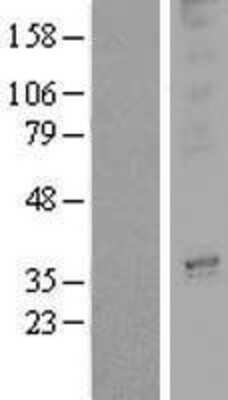Western Blot: OR3A2 Overexpression Lysate (Adult Normal) [NBP2-08100] Left-Empty vector transfected control cell lysate (HEK293 cell lysate); Right -Over-expression Lysate for OR3A2.