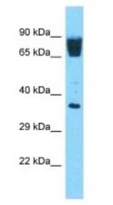 Western Blot: OR3A3 Antibody [NBP3-09739] - Western blot analysis of OR3A3 in Human 293T Whole Cell. Antibody dilution at 1ug/ml