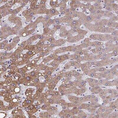 Immunohistochemistry-Paraffin: OR4A47 Antibody [NBP2-32493] - Staining of human liver shows moderate cytoplasmic positivity in hepatocytes.