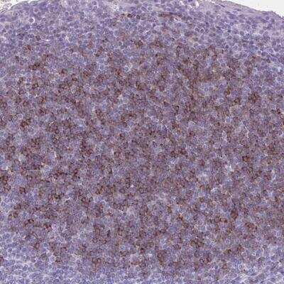 Immunohistochemistry-Paraffin: OR4B1 Antibody [NBP2-32461] - Staining of human tonsil shows moderate cytoplasmic positivity in non germinal center cells.