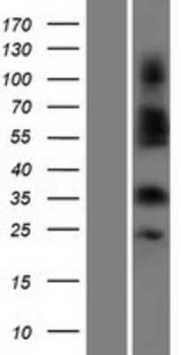 Western Blot: OR4C3 Overexpression Lysate (Adult Normal) [NBP2-08894] Left-Empty vector transfected control cell lysate (HEK293 cell lysate); Right -Over-expression Lysate for OR4C3.
