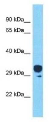 Western Blot: OR4C45 Antibody [NBP3-09781] - Western blot analysis of OR4C45 in Human HT1080 Whole Cell . Antibody dilution at 1ug/ml