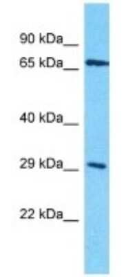 Western Blot: OR4D10 Antibody [NBP3-09784] - Western blot analysis of OR4D10 in Human HepG2 Whole Cell. Antibody dilution at 1ug/ml