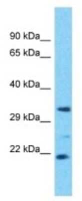 Western Blot: OR4D6 Antibody [NBP3-09783] - Western blot analysis of OR4D6 in Human OVCAR-3 Whole Cell. Antibody dilution at 1ug/ml