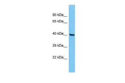 Western Blot: OR4F21 Antibody [NBP3-09788] - Western blot analysis of OR4F21 in MCF7 Whole Cell lysates. Antibody dilution at 1.0ug/ml