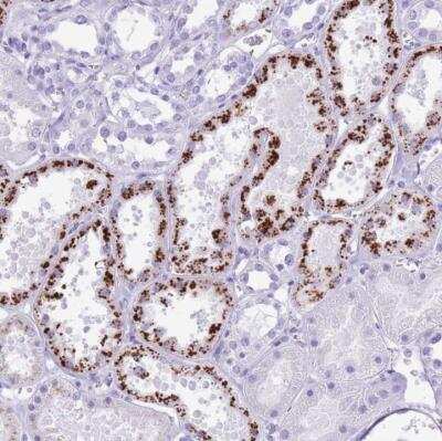 Immunohistochemistry-Paraffin: OR4F3 Antibody [NBP2-54734] - Staining of human kidney shows strong cytoplasmic positivity in granular pattern in renal tubules.