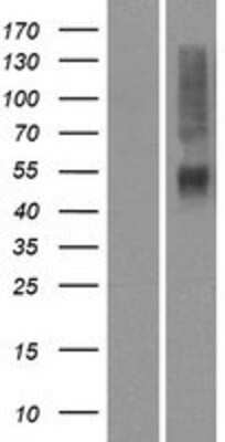 Western Blot: OR4K14 Overexpression Lysate (Adult Normal) [NBP2-08896] Left-Empty vector transfected control cell lysate (HEK293 cell lysate); Right -Over-expression Lysate for OR4K14.