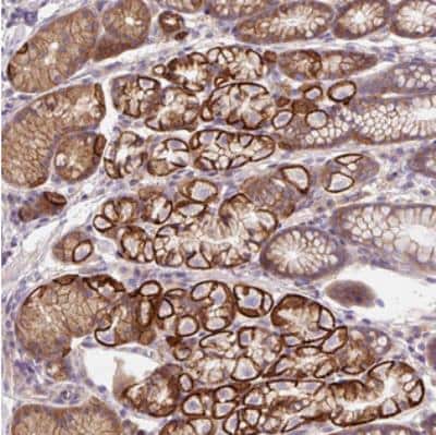 Immunohistochemistry: OR4K15 Antibody [NBP2-30939] - Staining of human stomach, lower shows strong cytoplasmic and membranous positivity in glandular cells.