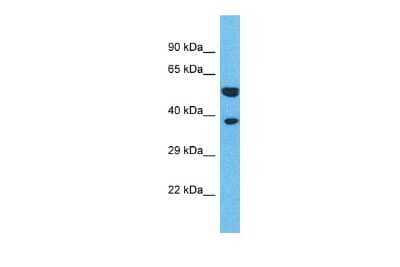 Western Blot: OR4L1 Antibody [NBP3-09791] - Western blot analysis of OR4L1 in Hela Whole Cell lysates. Antibody dilution at 1.0ug/ml