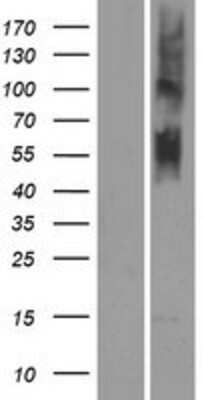 Western Blot OR4N5 Overexpression Lysate