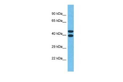 Western Blot: OR4Q3 Antibody [NBP2-83320] - Host: Rabbit. Target Name: OR4Q3. Sample Type: MCF7 Whole Cell lysates. Antibody Dilution: 1.0ug/ml