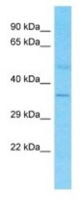 Western Blot: OR4S1 Antibody [NBP3-09789] - Western blot analysis of OR4S1 in Fetal Kidney lysates. Antibody dilution at 1.0ug/ml