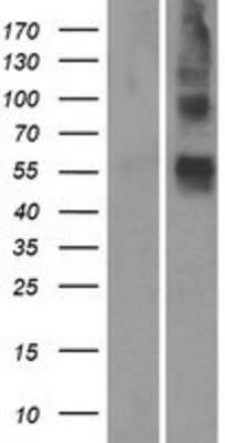 Western Blot: OR4S1 Overexpression Lysate (Adult Normal) [NBP2-08900] Left-Empty vector transfected control cell lysate (HEK293 cell lysate); Right -Over-expression Lysate for OR4S1.