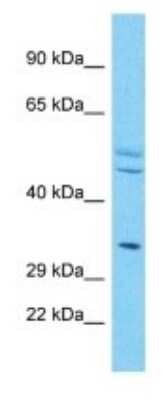 Western Blot: OR4X2 Antibody [NBP3-09790] - Western blot analysis of OR4X2 in HepG2 Whole Cell lysates. Antibody dilution at 1.0ug/ml