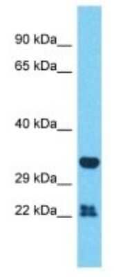 Western Blot: OR51A2 Antibody [NBP3-09861] - Western blot analysis of OR51A2 in RPMI-8226 Whole Cell lysates. Antibody dilution at 1.0ug/ml