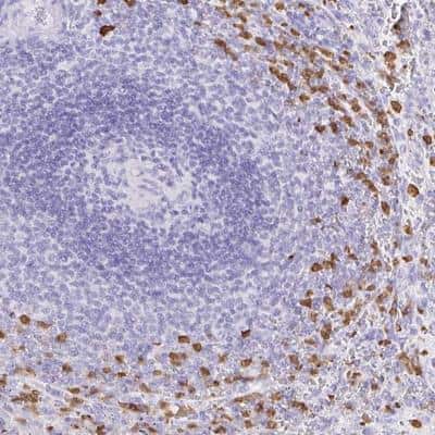 Immunohistochemistry-Paraffin: OR51A7 Antibody [NBP2-32348] - Staining of human spleen shows strong cytoplasmic positivity in cells in red pulp.