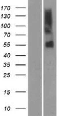 Western Blot OR51A7 Overexpression Lysate