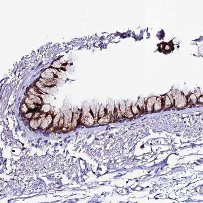 Immunohistochemistry-Paraffin: OR51Q1 Antibody [NBP1-86536] Staining of human bronchus shows strong cytoplasmic positivity in respiratory epithelial cells.