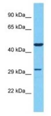 Western Blot: OR51S1 Antibody [NBP3-09864] - Western blot analysis of OR51S1 in Jurkat Whole Cell lysates. Antibody dilution at 1.0ug/ml