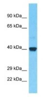 Western Blot: OR52B2 Antibody [NBP3-09865] - Western blot analysis of OR52B2 in Fetal Kidney lysates. Antibody dilution at 1.0ug/ml