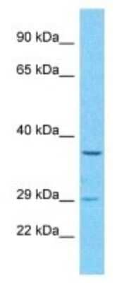 Western Blot: OR52B6 Antibody [NBP3-09866] - Western blot analysis of OR52B6 in HepG2 Whole Cell lysates. Antibody dilution at 1.0ug/ml