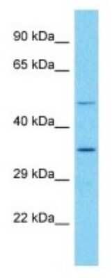 Western Blot: OR52E6 Antibody [NBP3-09867] - Western blot analysis of OR52E6 in HT1080 Whole Cell lysates. Antibody dilution at 1.0ug/ml