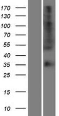 Western Blot: OR56B4 Overexpression Lysate (Adult Normal) [NBP2-08914] Left-Empty vector transfected control cell lysate (HEK293 cell lysate); Right -Over-expression Lysate for OR56B4.