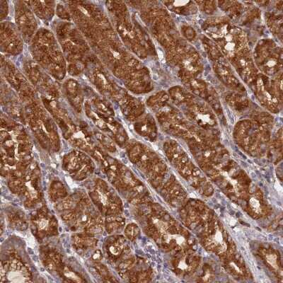 Immunohistochemistry: OR5A2 Antibody [NBP2-48867] - Staining of human stomach, upper shows strong cytoplasmic positivity in glandular cells.