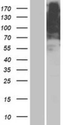 Western Blot: OR5AR1 Overexpression Lysate (Adult Normal) [NBP2-08903] Left-Empty vector transfected control cell lysate (HEK293 cell lysate); Right -Over-expression Lysate for OR5AR1.