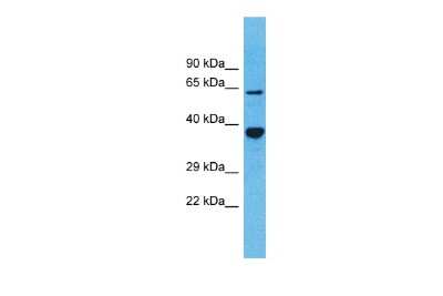 Western Blot: OR5D13 Antibody [NBP3-09800] - Western blot analysis of OR5D13 in Fetal Kidney lysates. Antibody dilution at 1.0ug/ml